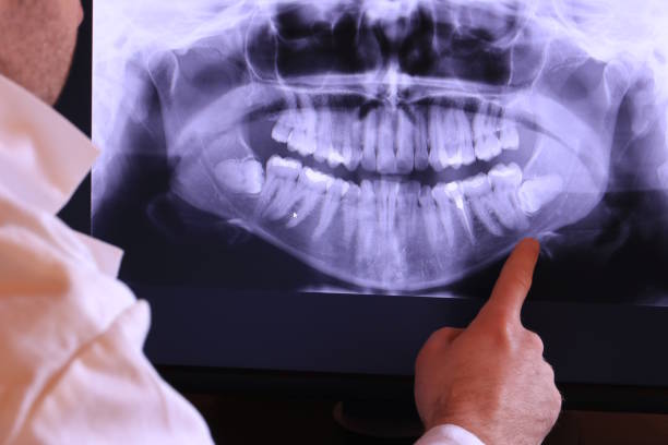 Best Mobile Emergency Dentist in Capron, IL