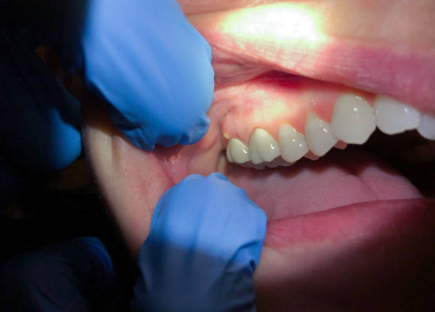 Best Pediatric Emergency Dentist in Capron, IL