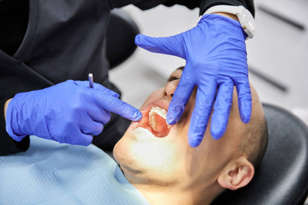 Best Emergency Dental Extractions in Capron, IL